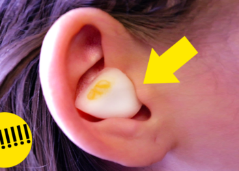 Comment soulager une otite remède Grand-mère ?