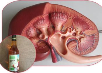 Comment lutter contre une insuffisance rénale légère ?