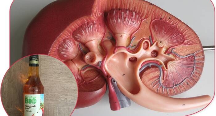 Comment lutter contre une insuffisance rénale légère ?