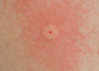 Comment reconnaître un insecte avec une photo ?