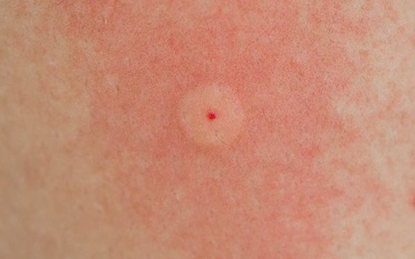 Comment reconnaître un insecte avec une photo ?