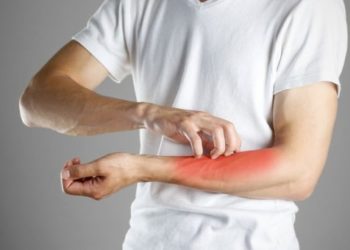 Comment se débarrasser de la gale chat ?