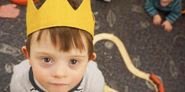 Est-ce que la trisomie existe chez les chiens ?