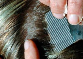 Est-ce que les poux partent au lavage ?