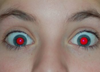Pourquoi mes yeux deviennent rouges ?