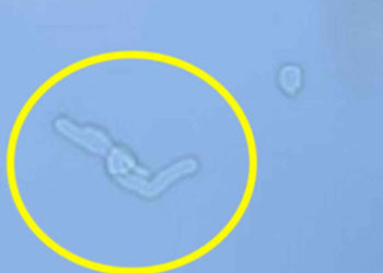 Est-ce que ça existe les yeux noirs ?