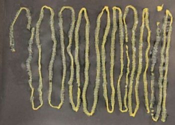 Comment se débarrasser du ver solitaire naturellement ?