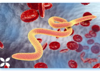 Comment se débarrasser des vers intestinaux naturellement ?