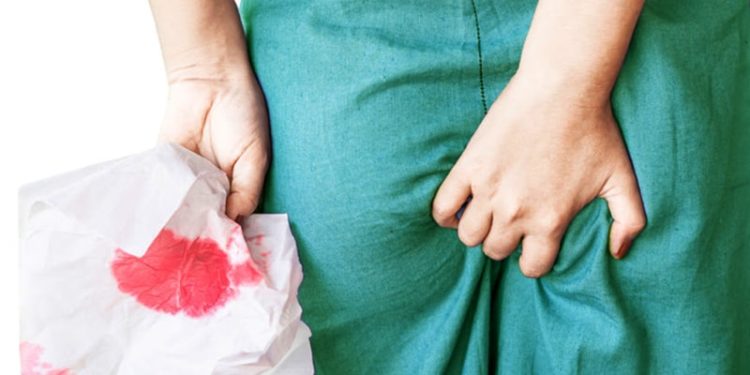 Quelles sont les causes d'un kyste ?