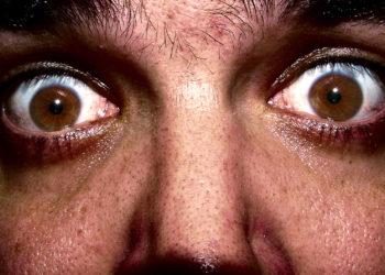 Est-ce qu'un chien peut mourir de peur ?