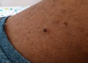 Est-ce que les tiques restent sur les vêtements ?