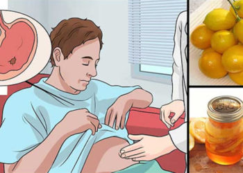 Est-il possible de traiter l'albinisme ?