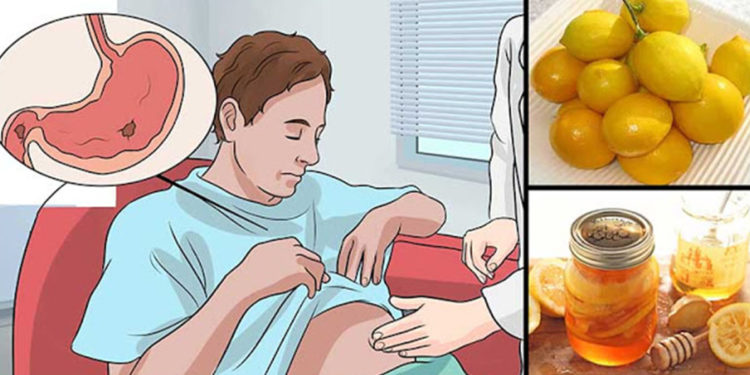 Est-il possible de traiter l'albinisme ?