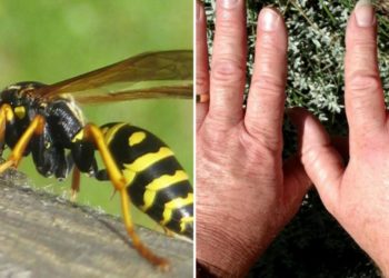 Comment savoir par quoi on a été piqué ?