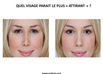 Comment faire pour ne plus avoir les pupilles Dilatee ?