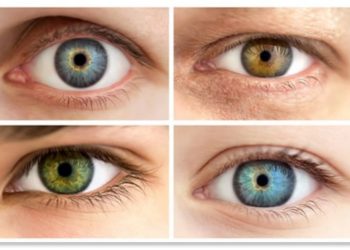 C'est quoi les yeux Hazel ?