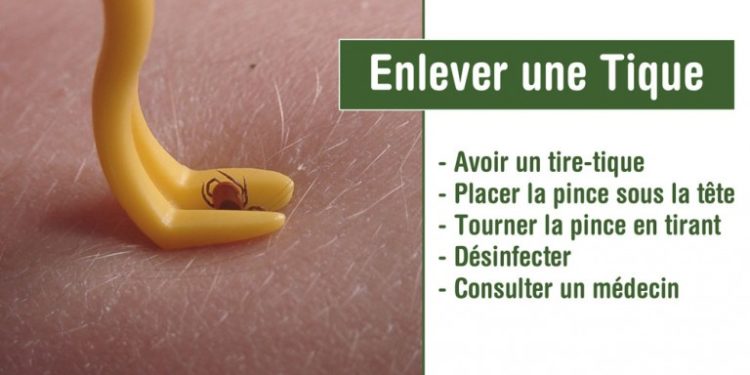 Comment faire mourir une tique ?