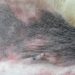 Pourquoi la peau du ventre de mon chien devient noire ?