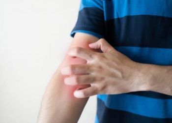 Comment se débarrasser de la teigne naturellement ?