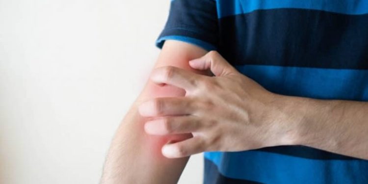 Comment se débarrasser de la teigne naturellement ?