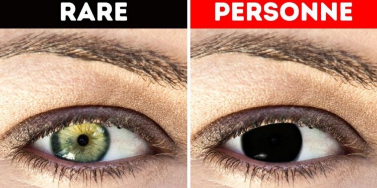 Pourquoi les humains n'ont pas les yeux jaunes ?