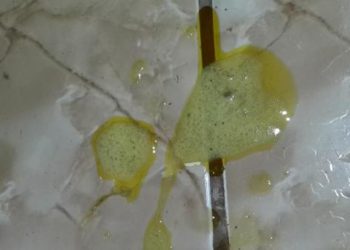 Quand on vomit de la bile que faire ?