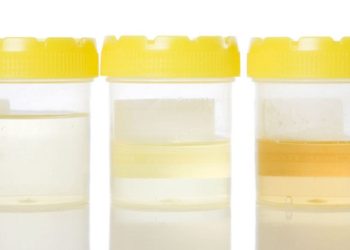 Quelle quantité d'urine sur 24 heures ?