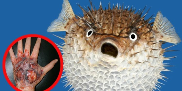 Quel est le poisson le plus dangereux au monde ?