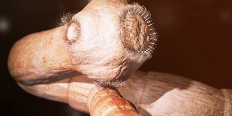 Est-ce qu'on sent bouger le ver solitaire ?