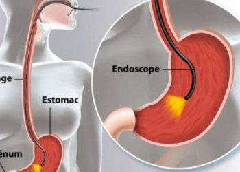 Qu'est-ce qui provoque l'Helicobacter pylori ?