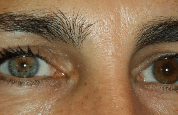Comment faire pour avoir les yeux vairons ?