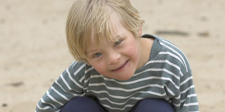 Quelle trisomie est la plus grave ?