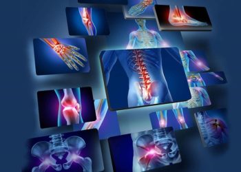 Quel est le rôle des anti-inflammatoire ?