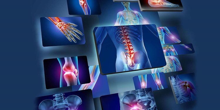 Quel est le rôle des anti-inflammatoire ?