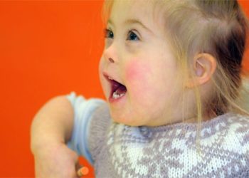 Est-ce que la trisomie existe chez les chats ?