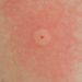 Comment reconnaître un insecte avec une photo ?