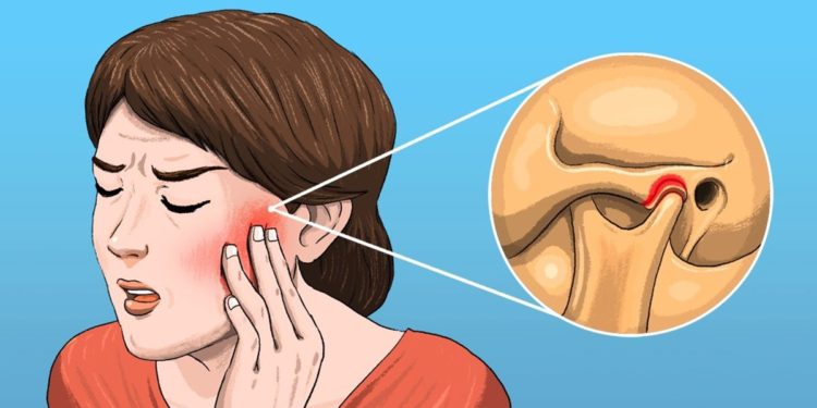 Qui consulter pour problème mâchoire ?