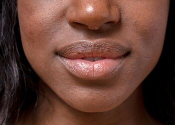 Comment aider la peau à cicatriser ?