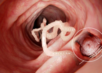 Comment savoir si on a le parvovirus ?