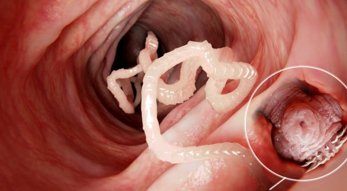 Comment savoir si on a le parvovirus ?