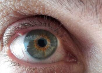 Comment traiter la Trichomonose sur le canari ?