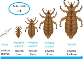 Est-ce que les poux peuvent partir tout seul ?