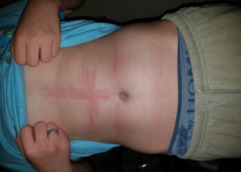 Est-ce que mordre est un signe d'affection ?