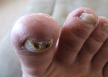 Quel âge couper griffes lapin ?