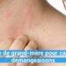 Quelle plante contre les démangeaisons ?