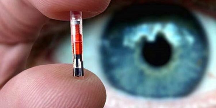 Qui peut lire puce chat ?